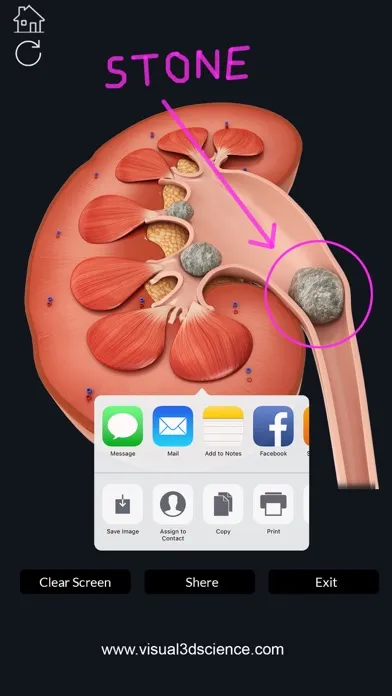 Tangkapan skrin My Kidney Anatomy